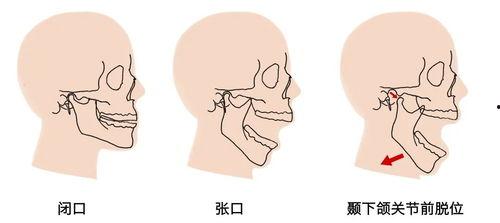吃瓜下巴脱臼视频,一场意外引发的围观热潮